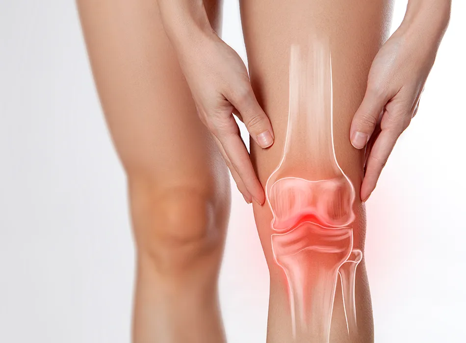 膝痛のイメージ2