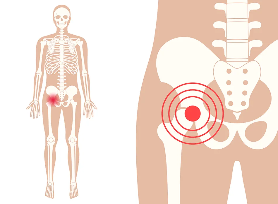 股関節の図